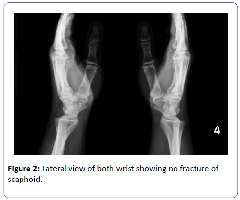 clinical-experimental-orthopedics-Lateral-view