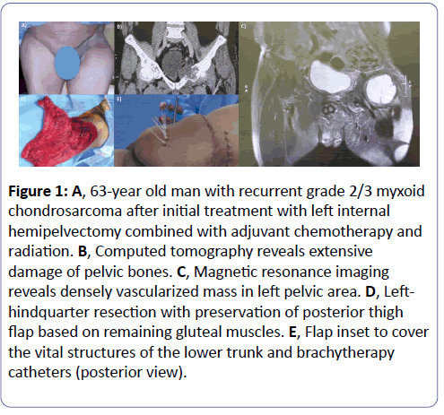 clinical-experimental-orthopedics-Magnetic-resonance