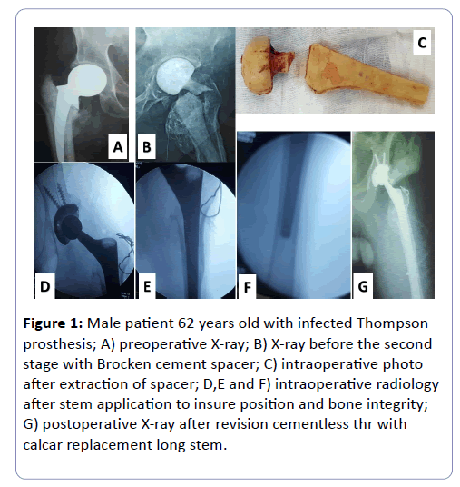 clinical-experimental-orthopedics-Male-patient