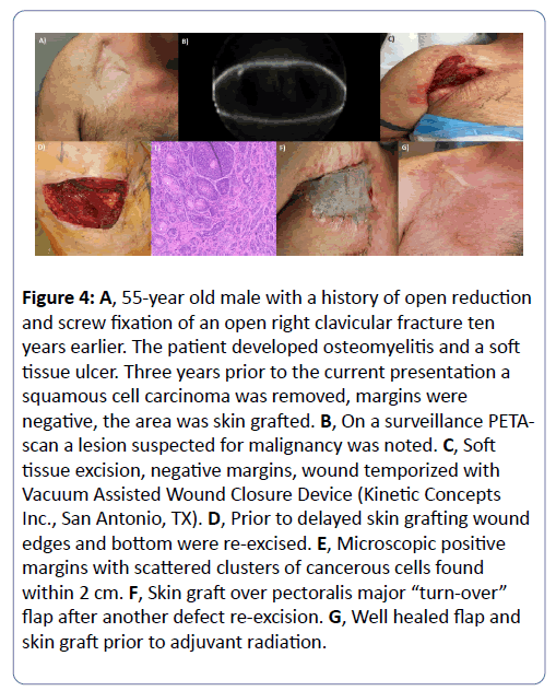 clinical-experimental-orthopedics-Microscopic-positive