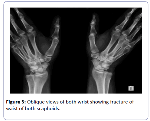 clinical-experimental-orthopedics-Oblique-views
