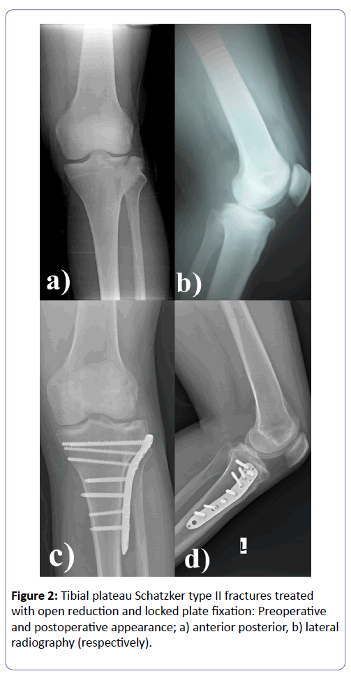 clinical-experimental-orthopedics-anterior-posterior