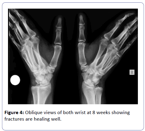 clinical-experimental-orthopedics-fractures-healing