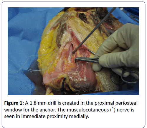 clinical-experimental-orthopedics-proximal-periosteal