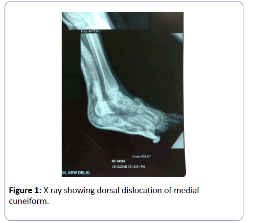 clinical-experimental-orthopedics-showing-dorsal