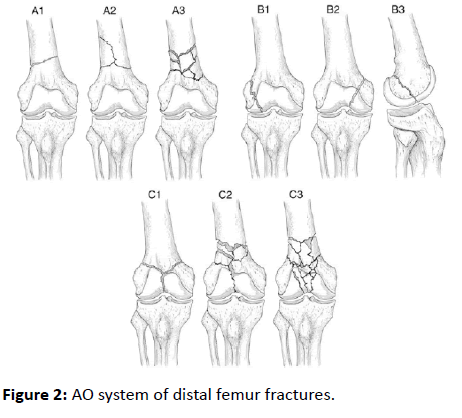 orthopedics-AO-system