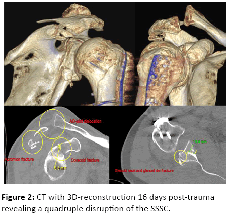 orthopedics-CT-3D-reconstruction