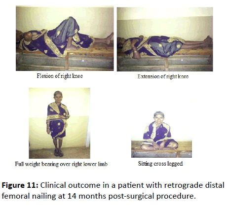 orthopedics-Clinical-outcome