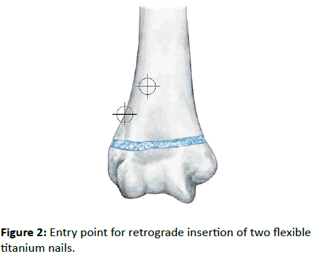 orthopedics-Entry-point