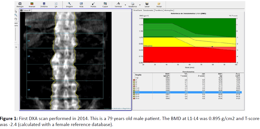 orthopedics-First-DXA-scan