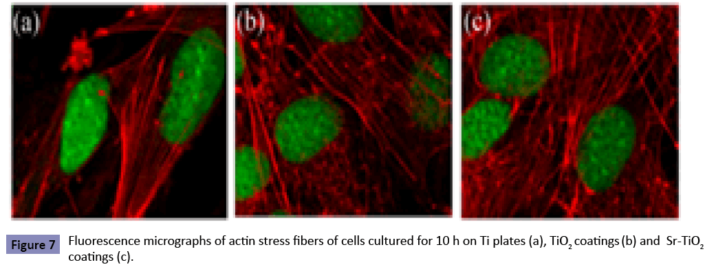 orthopedics-Fluorescence-micrographs-actin-stress