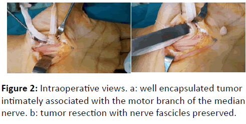 orthopedics-Intraoperative-views