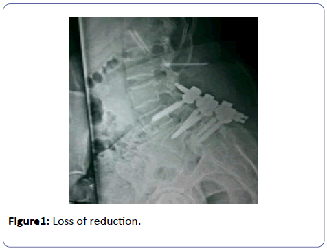 orthopedics-Loss-reduction
