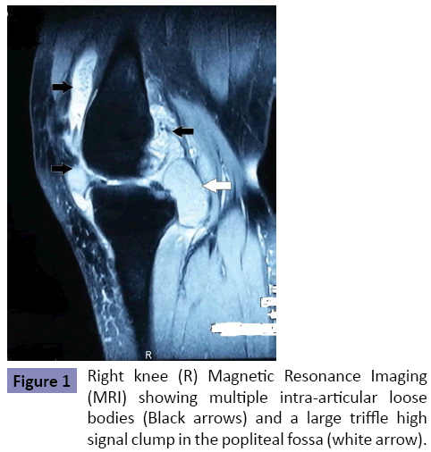 orthopedics-Magnetic-Resonance-Imaging