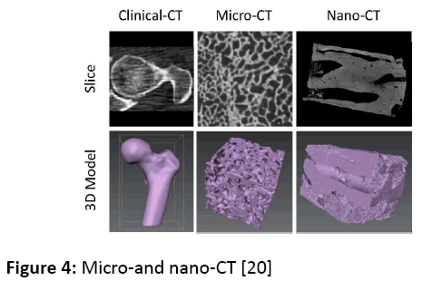 orthopedics-Micro-nano-CT