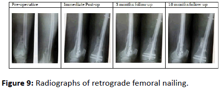 orthopedics-Radiographs