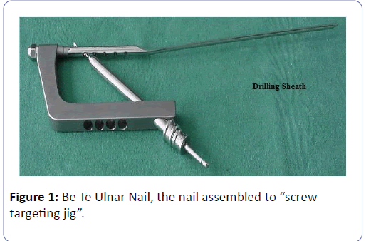 orthopedics-Ulnar-Nail