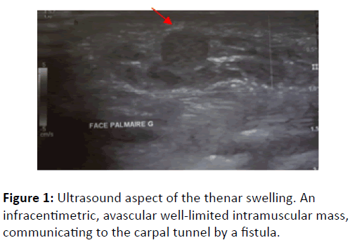 orthopedics-Ultrasound-aspect