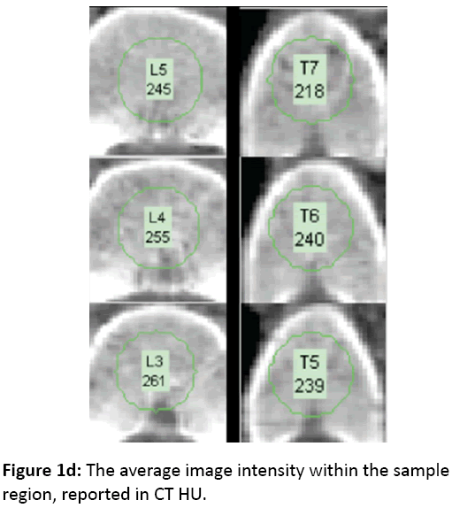 orthopedics-average-image-intensity