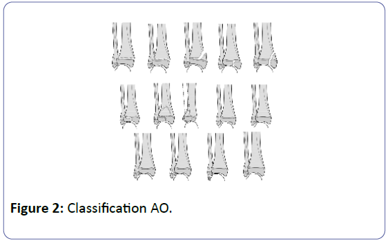orthopedics-classification-AO