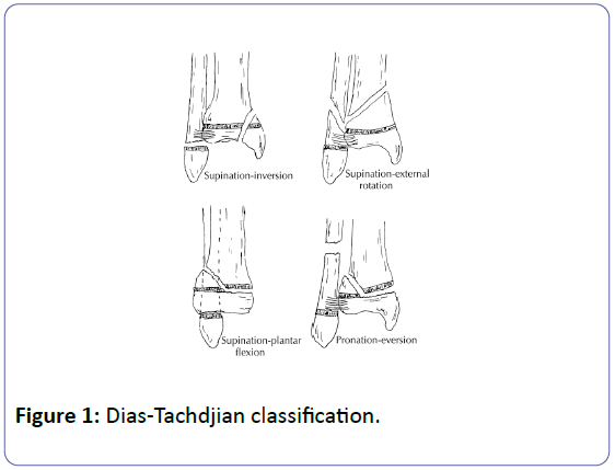 orthopedics-dias-tachdjian