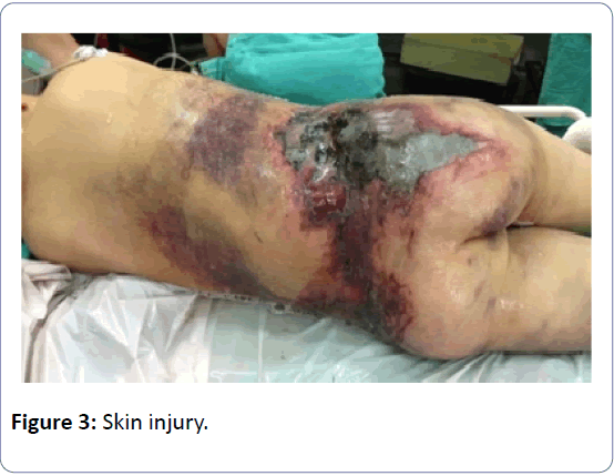 orthopedics-skin-injury